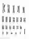 Fig. 03 - Composition for improving skin conditions using fetal mesenchymal stem cells from amniotic fluid