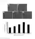 Fig. 07 - Composition for improving skin conditions using fetal mesenchymal stem cells from amniotic fluid