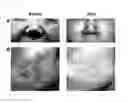 Fig. 14 - Composition for improving skin conditions using fetal mesenchymal stem cells from amniotic fluid