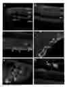 Fig. 01 - Widespread gene delivery to the retina using systemic administration of AAV vectors