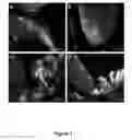 Fig. 04 - Widespread gene delivery to the retina using systemic administration of AAV vectors