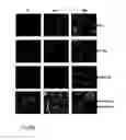 Fig. 07 - Adenovirus dodecahedron particles for delivery of pharmaceutical agents