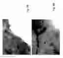 Fig. 07 - Tissue regeneration membrane