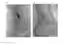 Fig. 01 - USE OF OLIVE LEAF EXTRACTS IN A PHARMACEUTICAL COMPOSITION FOR INDUCING ANGIOGENESIS AND VASCULOGENESIS