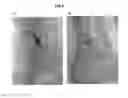Fig. 07 - USE OF OLIVE LEAF EXTRACTS IN A PHARMACEUTICAL COMPOSITION FOR INDUCING ANGIOGENESIS AND VASCULOGENESIS