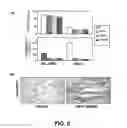 Fig. 06 - Methods of Use of Inhibitors of Phosphodiesterases and Modulators of Nitric Oxide, Reactive Oxygen Species, and Metalloproteinases in the Treatment of Peyronie's Disease, Arteriosclerosis and Other Fibrotic Diseases
