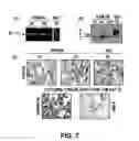 Fig. 08 - Methods of Use of Inhibitors of Phosphodiesterases and Modulators of Nitric Oxide, Reactive Oxygen Species, and Metalloproteinases in the Treatment of Peyronie's Disease, Arteriosclerosis and Other Fibrotic Diseases