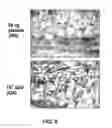 Fig. 09 - Methods of Use of Inhibitors of Phosphodiesterases and Modulators of Nitric Oxide, Reactive Oxygen Species, and Metalloproteinases in the Treatment of Peyronie's Disease, Arteriosclerosis and Other Fibrotic Diseases