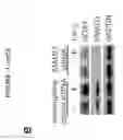 Fig. 06 - COMPOSITIONS AND METHODS FOR DIAGNOSING AND TREATING FIBROTIC DISORDERS