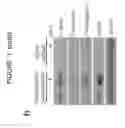 Fig. 09 - COMPOSITIONS AND METHODS FOR DIAGNOSING AND TREATING FIBROTIC DISORDERS