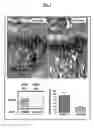 Fig. 04 - Methods of inhibiting metastasis from cancer