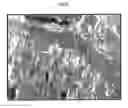 Fig. 11 - Methods of inhibiting metastasis from cancer