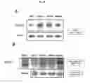 Fig. 14 - Methods of inhibiting metastasis from cancer