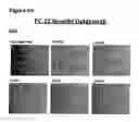 Fig. 82 - Methods of preventing inflammation and treating pain using anti-NGF compositions