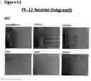 Fig. 83 - Methods of preventing inflammation and treating pain using anti-NGF compositions