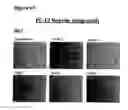 Fig. 89 - Methods of preventing inflammation and treating pain using anti-NGF compositions