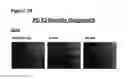 Fig. 96 - Methods of preventing inflammation and treating pain using anti-NGF compositions