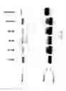 Fig. 10 - METHODS AND COMPOSITIONS FOR THE TREATMENT OF CANCERS AND PATHOGENIC INFECTIONS