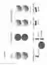 Fig. 40 - Method of increasing immunological effect