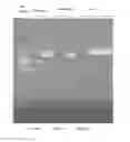 Fig. 01 - UNIVERSAL INFLUENZA VACCINE BASED ON RECOMBINANT MODIFIED VACCINE ANKARA VIRUS (MVA)