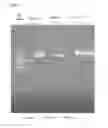 Fig. 02 - UNIVERSAL INFLUENZA VACCINE BASED ON RECOMBINANT MODIFIED VACCINE ANKARA VIRUS (MVA)