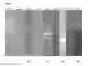 Fig. 13 - UNIVERSAL INFLUENZA VACCINE BASED ON RECOMBINANT MODIFIED VACCINE ANKARA VIRUS (MVA)