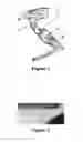 Fig. 02 - Botulinum toxin formulation