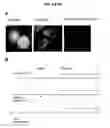 Fig. 07 - Mycobacterial mutants inducing IL-12
