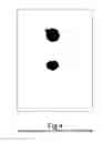 Fig. 05 - Drug delivery system