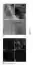 Fig. 12 - METHODS OF MAKING CELL SHEETS, TISSUE SHEETS AND TISSUE ENGINEERED BLOOD VESSELS