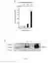 Fig. 05 - BIOCOMPATIBLE POLYMER FIBRES FOR NEUROIMPLANTS