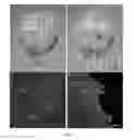 Fig. 11 - BIOCOMPATIBLE POLYMER FIBRES FOR NEUROIMPLANTS