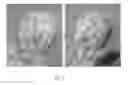 Fig. 12 - BIOCOMPATIBLE POLYMER FIBRES FOR NEUROIMPLANTS