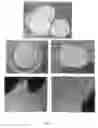 Fig. 06 - BIO-MEMBRANE FOR TISSUE REGENERATION