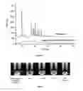 Fig. 05 - NANOPARTICULATE CANDESARTAN CILEXITIL COMPOSITIONS, PROCESS FOR THE PREPARATION THEREOF AND PHARMACEUTICAL COMPOSITIONS CONTAINING THEM