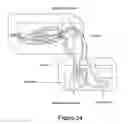 Fig. 16 - CELL COATED IMPLANTABLE DEVICE