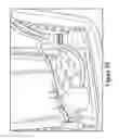 Fig. 33 - CELL COATED IMPLANTABLE DEVICE