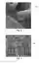 Fig. 03 - Wipe coated with a botanical composition having antimicrobial properties