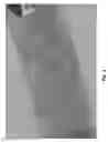 Fig. 04 - Surface Coating for Biomedical Implants and Electrodes