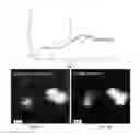 Fig. 05 - PARTICLES FOR DRUG DELIVERY AND OTHER APPLICATIONS