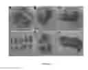 Fig. 06 - UMBILICAL CORD AMNIOTIC MEMBRANE PRODUCTS