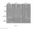 Fig. 13 - UMBILICAL CORD AMNIOTIC MEMBRANE PRODUCTS