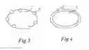 Fig. 04 - METHOD OF APPLYING A METALLIC PRECURSOR TO A TITANIUM OXIDE COATING TO FORM A COMPOSITE COATING OR MATERIAL