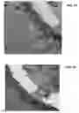 Fig. 40 - Ion sources, systems and methods