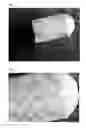 Fig. 02 - Biphasic Collagen Membrane or Capsule for Guided Tissue Regeneration