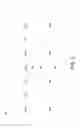 Fig. 06 - Template-registered diblock copolymer mask for MRAM device formation