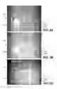 Fig. 07 - Microfabricated integrated DNA analysis system