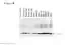 Fig. 05 - Method for extraction and purification of recombinant proteins from transgenic plants