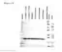Fig. 08 - Method for extraction and purification of recombinant proteins from transgenic plants