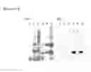 Fig. 11 - Method for extraction and purification of recombinant proteins from transgenic plants